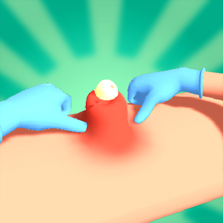 Pimple uitknij